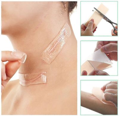 Silikoniarpien laastarit Arpi laastarit Silikoniarpien laastarit Uudelleenkäytettävät ja tehokkaat arpien poistolevyn arpihanarullat arven pehmentä...