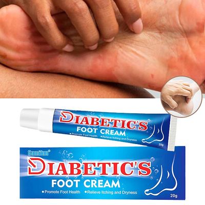 Mylight 1/2pcs 20g Diabetic's Foot Cream Itchy Foot Care Salve Forbedre Skin Radiance 2 stk.