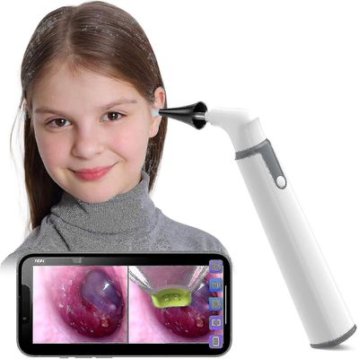 2024 Ny Trådlös Otoskop Öronkamera Med Dual View, 3,9 mm 720PHD Wifi Öronomfång Med 6 LED-lampor Hög Kvalitet