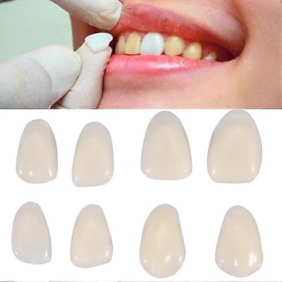 70kpl/pussi Hampaiden viilut Hartsi Anterior Upper Temporary Crown hammashoitoon
