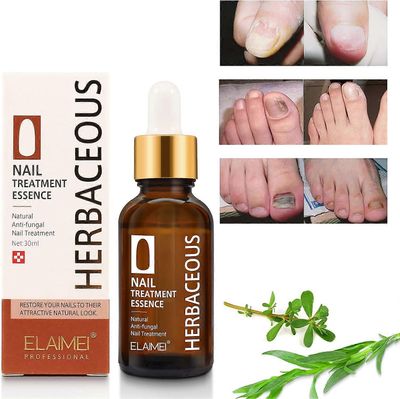 Unbrand Kynsien korjausseerumi, Anti Fungus Treatment Kynsien vahvistaja seerumi, Fungus Nails Renewal Solution vaurioituneille ja värjäytyneille k...