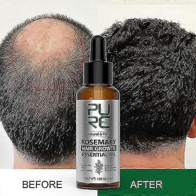 Rosmariiniöljy Hiusten kasvutuotteet miehille Naiset Inkivääri Anti Loss Nopea uudelleenkasvu Sakeuttaa öljyjä Päänahan hoito Hoito