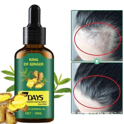 unbrand Hair Regrow 7 Day, Ginger Germinal Essential Oil Hiusten Kasvu Hiustenlähtöhoito Hiustenhoito Hiusten Kasvuseerumi miehille ja naisille 30m...