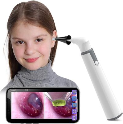 trådløs otoskop ørekamera med dobbel visning, 3,9mm 720phd wifi øreomfang med 6 led lys