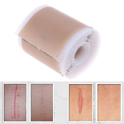Den nye type silikone Scar Removal Patch er velegnet til acne traumer og brænde hud Sm928