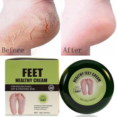 Frusde Foot Repair Cream, fuktighetsgivende fotkrem for tørre sprukne hæler Callus Remover Hand Cream Foot Cream Advanced Repair Cream 2pcs