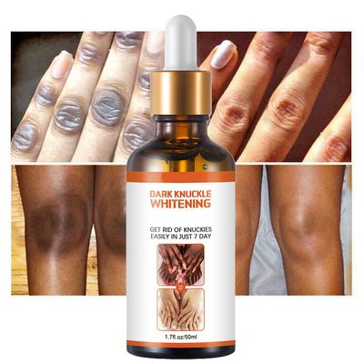 Siguang 2022 Sterk bleking serum for fjerning mørk knoke finger albue og kne