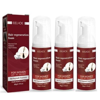 3kpl Naisten otsatukka 5% vaahtoa oheneville hiuksille ja hiustenlähtöön, hiusten uudelleenkasvun hoitoon