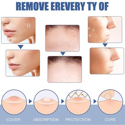 Skin Tags Føflekker Remover-Patches Kvise Wart Behandling-rask absorbere (144pcs/box)