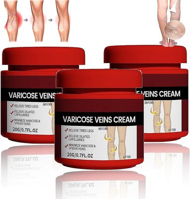 Frusde Cream åreknuter, åreknuter behandling for bena, åreknuter &; beroligende ben krem styrke kapillær helse reduserer edderkopp årer 3pcs