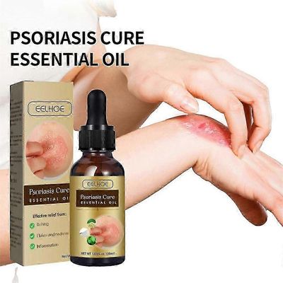 1-3PCS psoriaasin helpotuksen eteerinen öljy lievittää ihon kutinaa korjaava ihonhoitoöljy, voimakas mieto yrtti 1pc