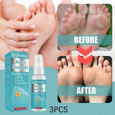 1kpl urheilijan jalkasuihke, haisevat jalat, kutiavat jalat, hikinen haju, mätä jalat, kutinaa estävä urheilijan jalkasuihke 3PCS