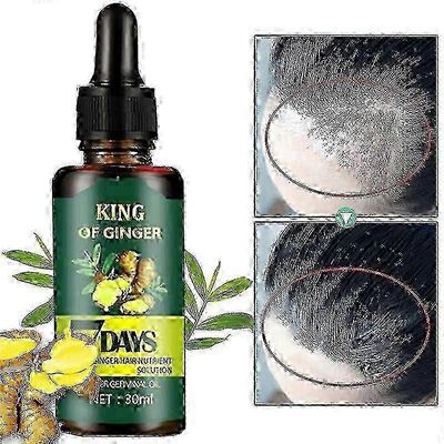 Inkivääri hiustenhoito hiustenlähtö 7 päivää parantaa päänahan ympäristöä Anti-dropping hiukset