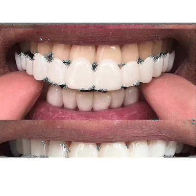Uusi Snap On Smile Dental False Teeth Cover Smile Iluers Comfort Fit Flex Proteesin hampaat - Niubi_l25 Ylemmät hampaat