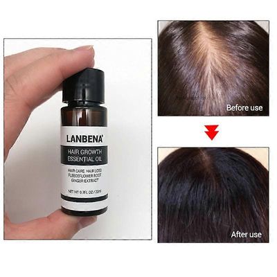 20ml hiusten kasvu Eteerinen öljy Hiustenhoito Hiustenlähtö Fleeceflower Root Ginger Extract Lanbena Meikki