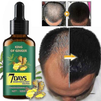 Nopea hiusten kasvu inkivääri hiusten kasvu essence hiustenhoito hiustenlähtöhoito isän lahja