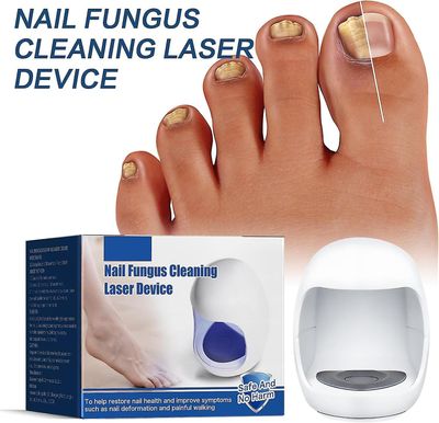 Nail sopp lys terapi enhet, spiker sopp behandling lampe, spiker sopp fjerning enhet, Nail skjønnhet enhet for kvinner