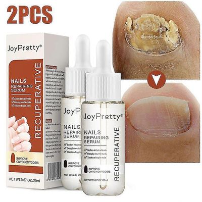 Sienikynsien hoito seerumi paksu kynsien pehmeä kynsien korjaus esanssivoide varpaiden valkaisuhoito hoito TW 2kpl