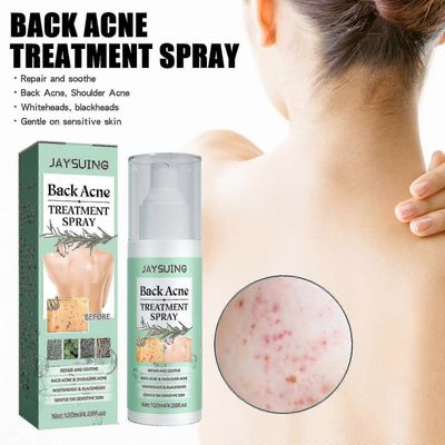 Jaysuing Back Acne Repair Spray häivyttää aknen jälkiä, korjaa selkää, hartioita ja vartaloa, puhdistaa ja tasoittaa ihoa BF -8415342915523