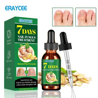 7 päivän kynsien kasvuseerumi, 7 päivän inkiväärikynsien esanssi, monikäyttöinen kynsien korjaus, kynsien ravinneöljyn vahvistajaöljy 3pcs