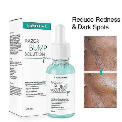 Razor Bumps -hoito naisille ja miehille, Anti-Bumps Solution, After Shave Repair -seerumi, vähentää punoitusta ja tummia pisteitä, estää sisäänkasv...