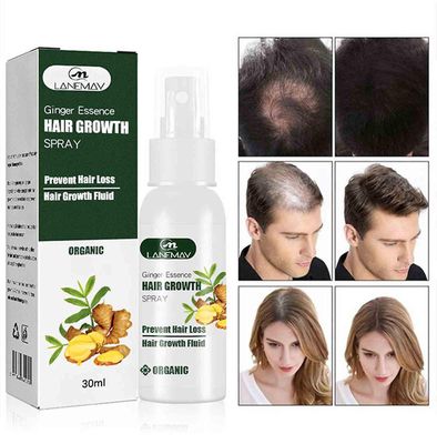 Baodan Ginger essens spray for hårvekst 30ml