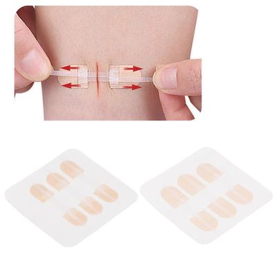 3kpl hätähaavan sulkemisompeleita itseliimautuva haavan sulkemislaite ulkona hätähaavan sulkemislaitteelle