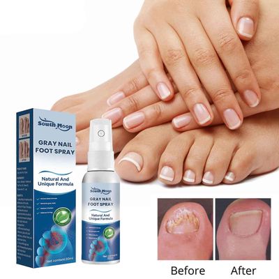 Flye Antifungale midler neglebehandlinger spray i medicinsk kvalitet, 30 ml, svampedræbende neglebehandlinger, svampemidler spray 30ml Blå