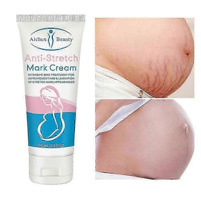 sopii etanalle Poistaa venytysmerkkivoide synnytyksen jälkeisen liikalihavuuden poistamiseksi Raskaana olevat naiset korjaavat ikääntymistä estäviä...