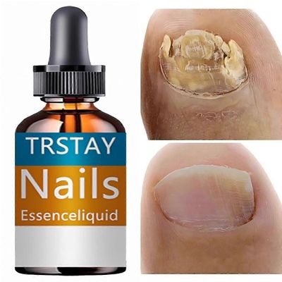 Kynsien ihme: kovettuminen, pirstoutumisen estäminen, ruiskutettu hajuttomalla luonnollisella keratiinilla, joka tuo kiiltoa 50ml