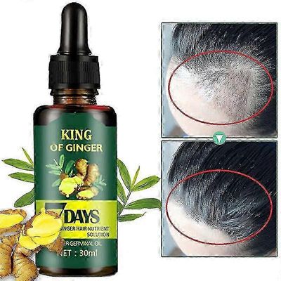 Ginger Hair Care Hiustenlähtö 7 Day parantaa päänahan ympäristöä Anti-dropping Hair -8211715795132