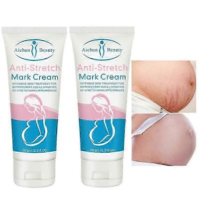 2x poistaa venytysmerkkivoiteen raskaana olevat naiset korjaavat ikääntymistä estävän vinksejä estävän voiteen Lisää ihon kimmoisuutta Sileä kiinte...