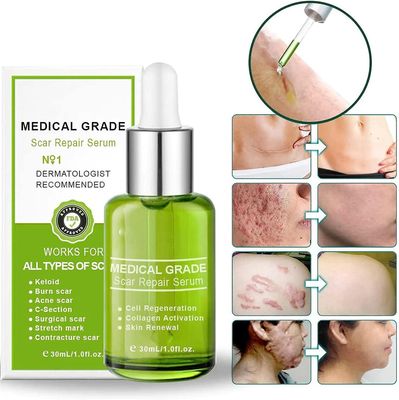 Fongwan Advanced Scar Repair Serum, Medical Grade Scar Repair Serum, Medical Scar Removal Spray, Scar Fjern behandling for alle typer arr 2 stk -30 ml