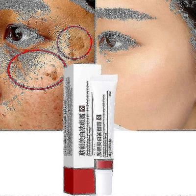 Kerma melasman ja melaniinin poistamiseksi - 2023 Changzhaon ihonhoito - S- ja L-koot Tw 1 kpl