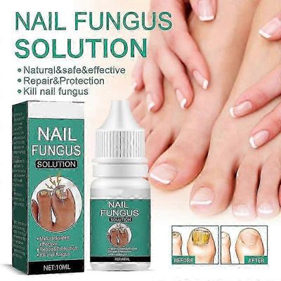 Kynsisienihoito varpaankynsille Erittäin vahva, sisäänkasvanut varpaankynsien hoito Kynsienhoitoöljyt, varpaankynsien sienihoito 3 kpl