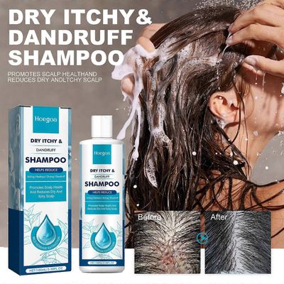 Seborrooinen dermatiitti Psoriasis Shampoo-päänahka follikuliittiin Psoriasis Kuiva kutiava päänahka Rasvainen 100ml 3pcs