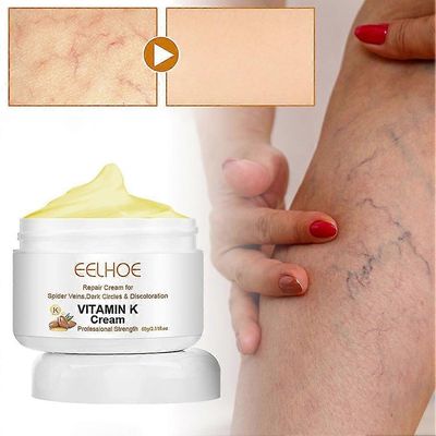 60g K-vitamiinivoidetta suonikohjujen hoitoon Monikäyttöinen suonikohjuhierontavoide löysille jaloille kainalosuonijalat 3pcs