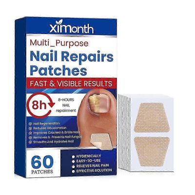 2025 60kpl varpaankynsien hoitotarrat sisäänkasvava varpaankynsien kynsien korjauslaastari