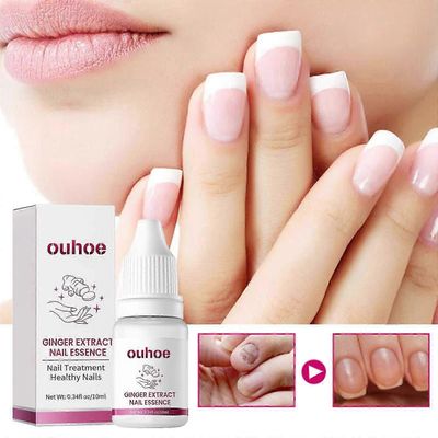 Ginger Nail Care Essence, Grey Nail Moisturizing Care Exfoliating Beauty Nail Essence