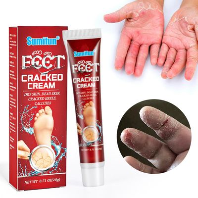 Kakanwo Hånd og fot sprukne Cream Dry Cracking Anti-Cracking Cream Flerfarget One Size