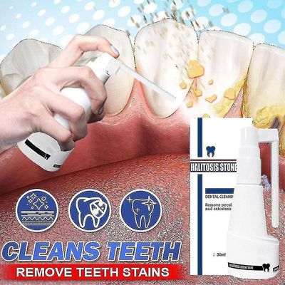 10/30ml Dental Calculus Rengjøring Halitosis Stone Fjern Teeth Whitening TW 10ml
