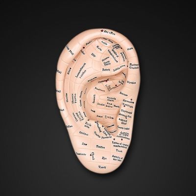 300st Magnetisk terapi Öronplåster Auricular Auriculotherapy Akupunktur Frö Gold