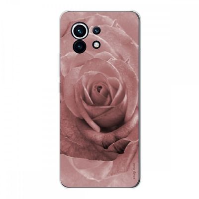 Crazy Kase Shell til Xiaomi Mi 11 Blød silikone 1 mm, Pink Pastel Farve