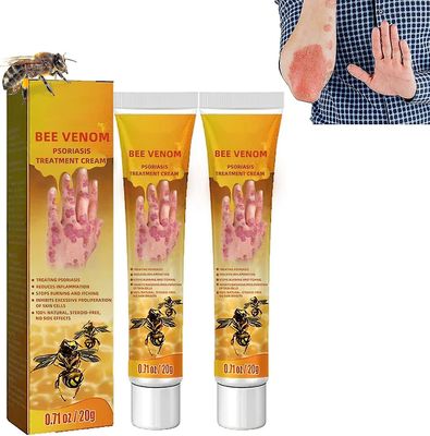 Bee Venom Psoriasis Treatment Cream, New Zealand Bee Venom Professional Psoriasis Treatment Cream, beroligende og fuktighetsgivende psoriasis Cream...