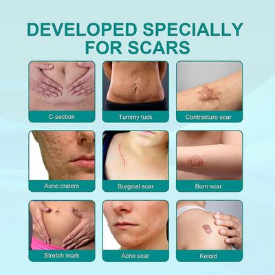 Scarremove Advanced Scar Spray kaikentyyppisille arpeille - erityisesti aknearvet Scar Remove Advanced Scar Spray (2 kpl)