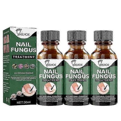 3x harmaa kynsien korjaus essence paksuuntumistyyppi harmaa kynsien korjaus essence kynsien paksuuntumisväri putoaa pehmeästä kynnestä