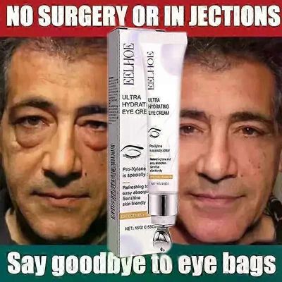 Gaibosi Silmänympäryspussien poistovoide Ryppyjä ehkäisevä Haalistuneita linjoja Kiinteyttävä Iho Turvotusta Estävä Silmänympäryshoitotuote