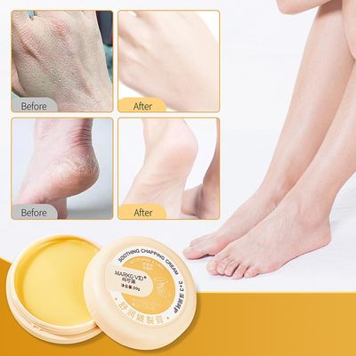 Kakanwo Cracking Cream Chapping Cream Hånd og fotpleie Antifreeze Foot Cracking Cream Heel Cracking Dry Cracking Frostbite Repair Cream Winter Anti...