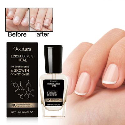Unbrand Onycholysis Heal kynsien vahvistaminen ja kasvuhoitoaine, onykolyysikynsien hoito, onykolyysihoito, onykolyysi paraneminen 2kpl