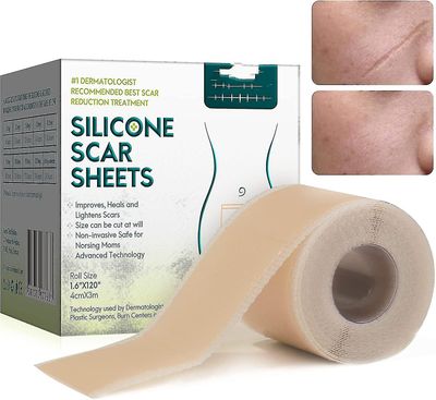 Silikone plaster til ar, silikone ar film til operationer, kejsersnit, keloider, forbrændinger, silikone ar tape-4cm * 3m